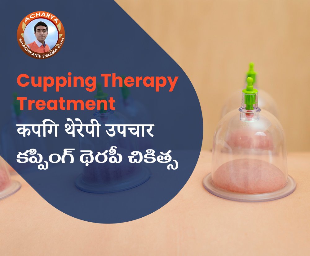 Cupping Therapy Website