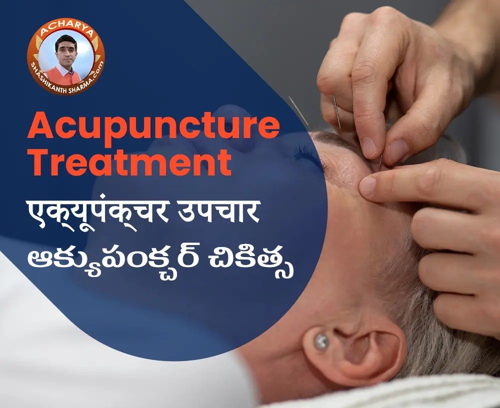 Acupuncture