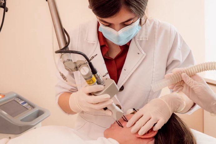 Co2 Laser Treatment
