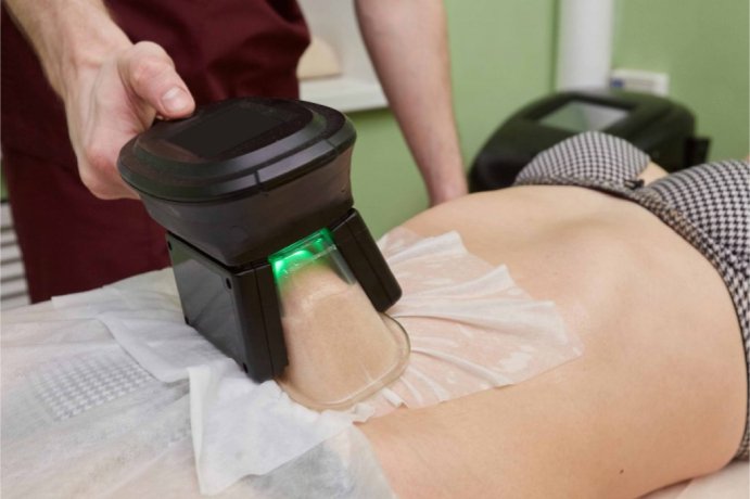 Cryolipolysis