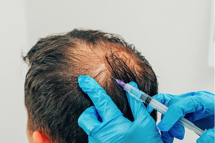 Hair Growth Treatments