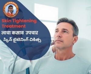 Skin Tightening Img