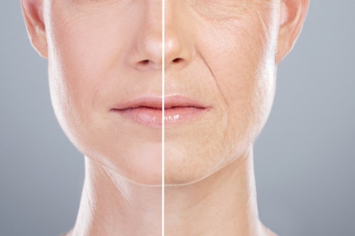 Anti Aging